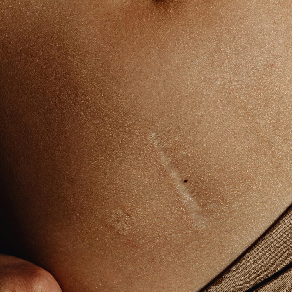 cabinet-louva-soins-dermo-esthetique-capillaire-minceur-visage-cure-image-corporelle-perpignan-pyrenees-orientales