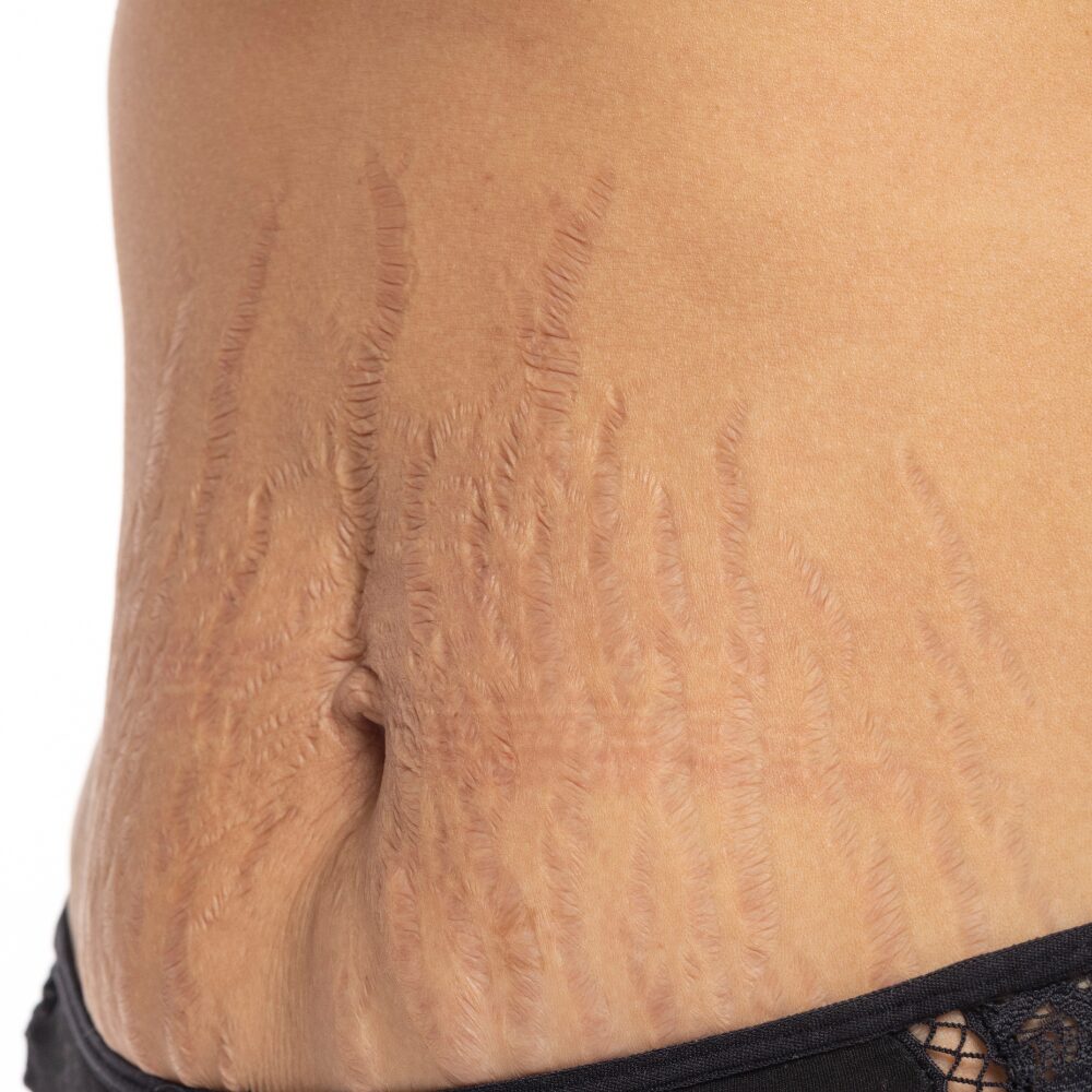 cabinet-louva-soins-dermo-esthetique-capillaire-minceur-visage-cure-image-corporelle-perpignan-pyrenees-orientales