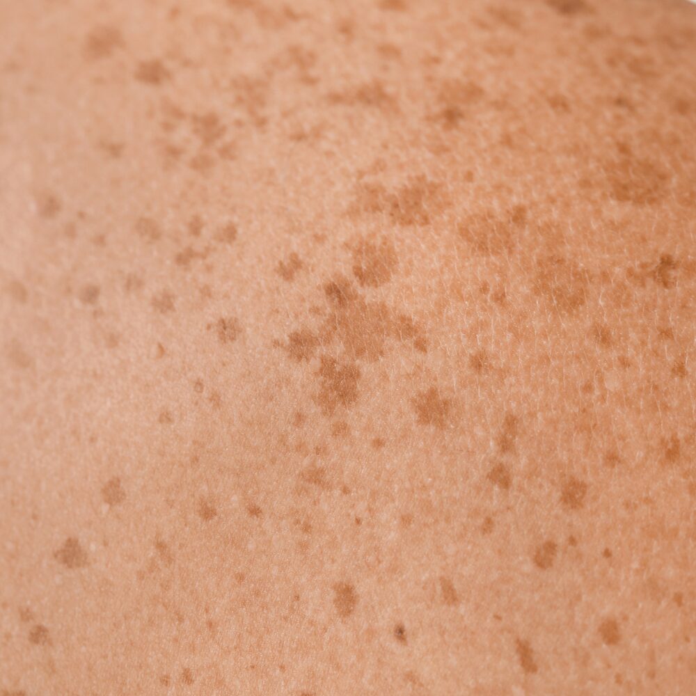 cabinet-louva-soins-dermo-esthetique-capillaire-minceur-visage-cure-image-corporelle-perpignan-pyrenees-orientales